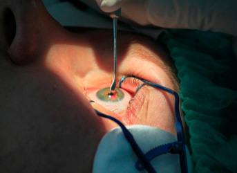 Смотрим прямо в глаза. Чем занимаются офтальмологи?