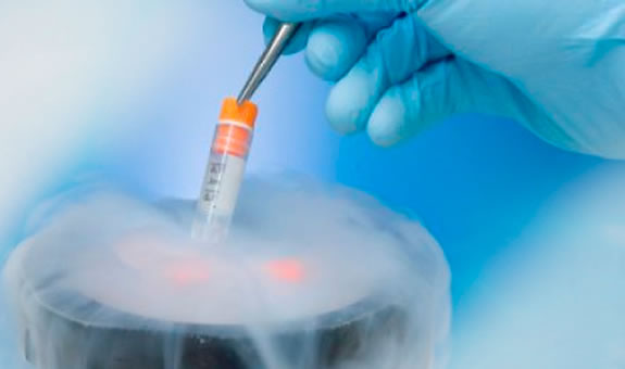 Криоконсервация эмбрионов