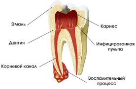 Зубная киста – симптомы, виды, лечение