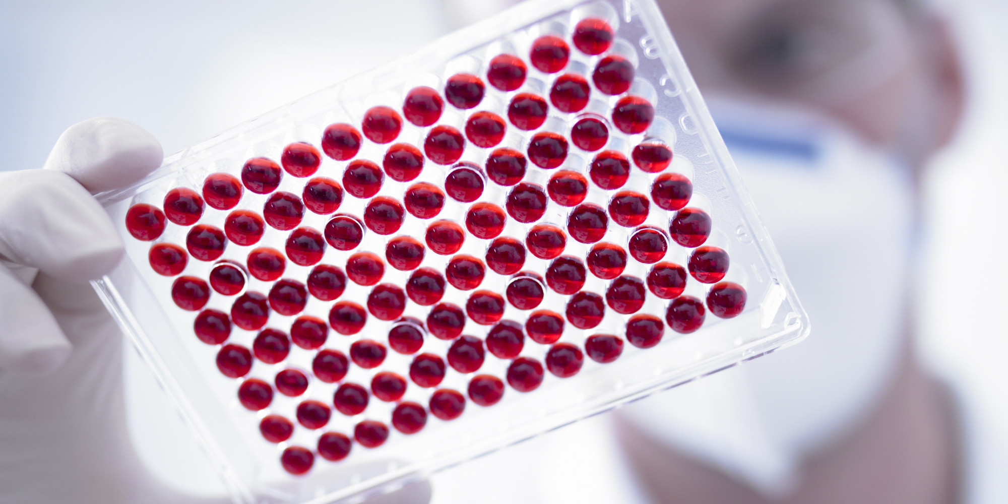 Расшифровка анализа крови: лейкоциты и СОЭ. Повышены, понижены, норма?