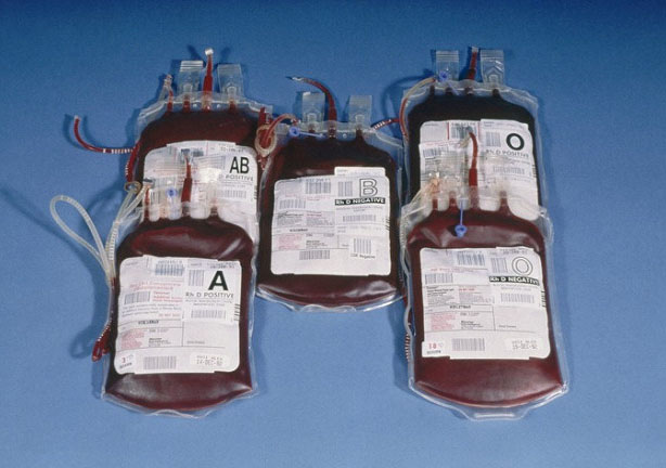 Донорские клетки крови и растворы для переливания