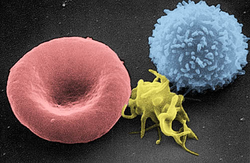 Слева направо: эритроцит, тромбоцит и лейкоцит (сканирующая электронная микроскопия)