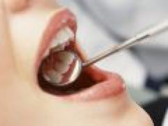 Профессиональная чистка зубов: профилактика заболеваний зубов и десен