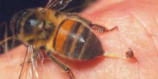 Первая помощь при укусах пчел и ос 