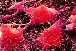 Видео: Лимфоциты и онко-клетки 