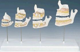 Видео:формирование зубного ряда
