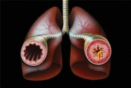 Бронхиальная астма. Виды, симптомы, диагностика и лечение бронхиальной астмы