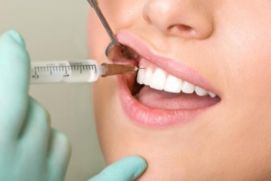 Что собой представляет местная анестезия в стоматологии