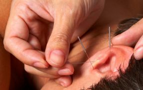 Аурикулярная (ушная) акупунктура — что вы знаете об этом методе лечения без лекарств и скальпеля?