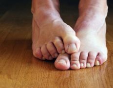 Как правильно проводить лечение потливости ног?