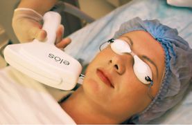 Технология Элос — лазерное удаление купероза, шрамов и бородавок 