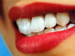 Лучшая стоматология мира доступна казахстанцам в ЦИМ