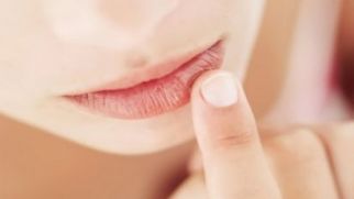 Потрескавшиеся губы: причины и лечение