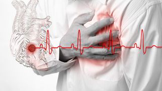 Инфаркт: симптомы и лечение