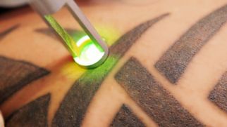 Как правильно вывести татуировку