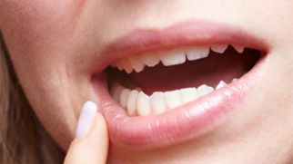 Пузырь на внутренней стороне губы — причины и лечение