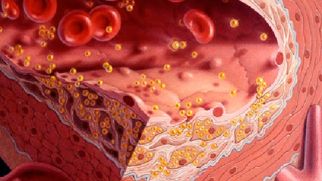 Норма холестерина в крови у женщин и мужчин по возрасту