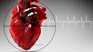 Инфаркт миокарда: причины и симптомы