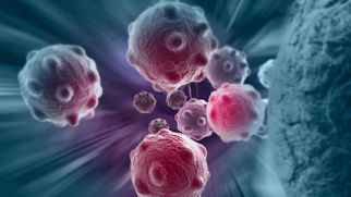 Что такое метастазы и почему клетки опухоли бессмертны
